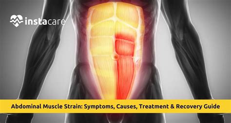 Muscle Strain In The Stomach