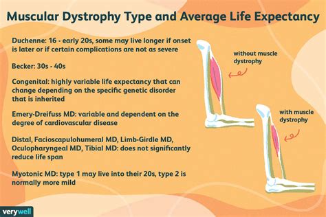 Muscular Dystrophy Average Lifespan