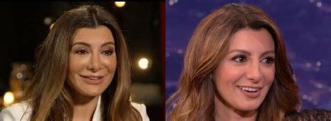Nasim Pedrad Face Surgery