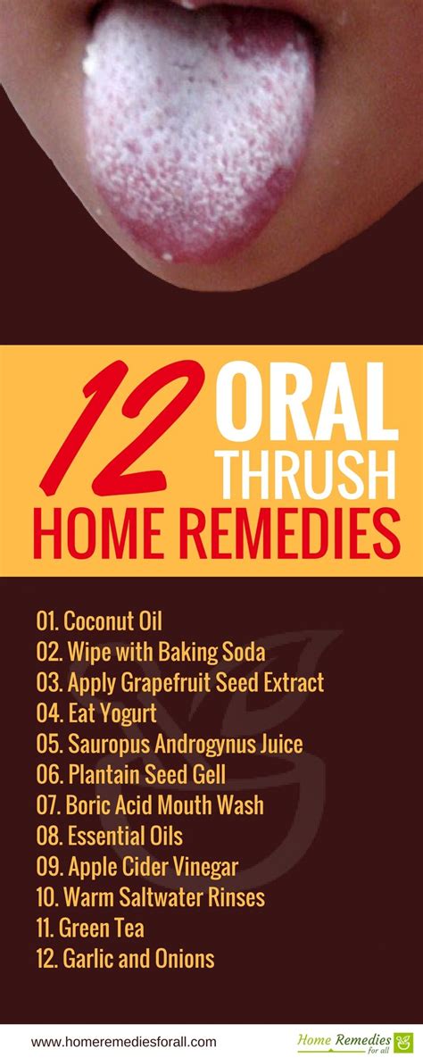 Natural Remedies For Oral Thrush