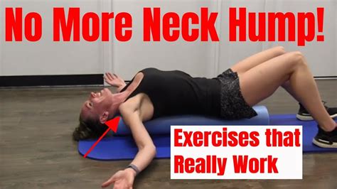 Neck Hump Exercises