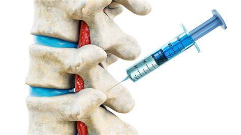 Nerve Deadening Injections