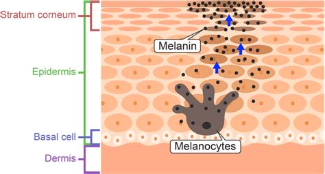 Nest Of Melanocytes