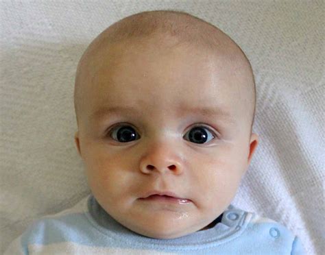 Newborn Large Head