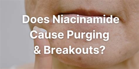 Niacinamide Does It Cause Purging