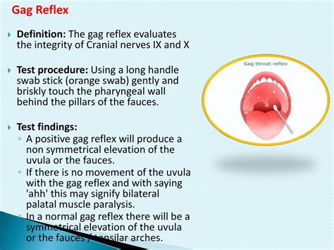 No Gag Reflex