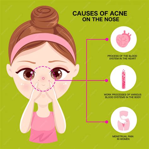 Nose Pimple Means