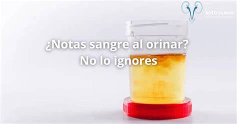 Orinar Y Sangrar