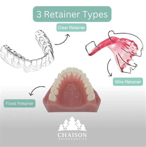 Orthodontic Retainer Braces