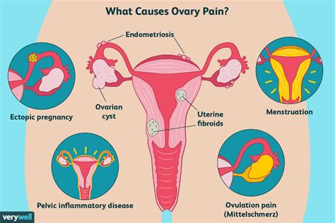 Ovaries Hurt After Sex