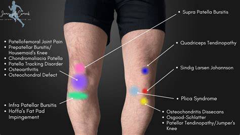Pain Above Kneecap