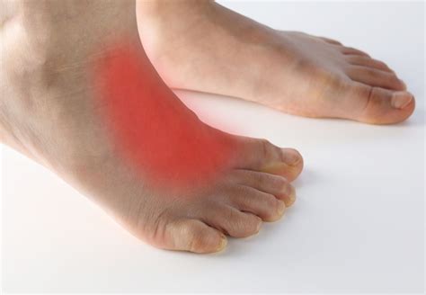 Pain Across Top Of Foot