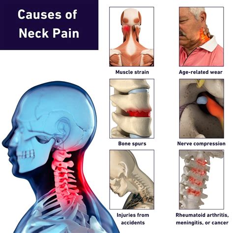 Pain At Base Of Neck