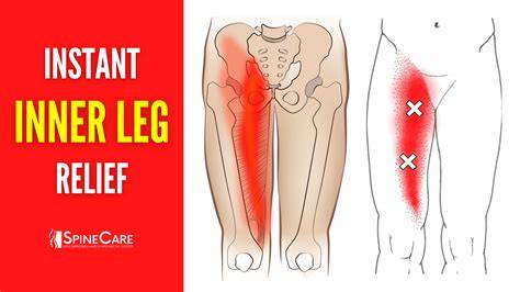 Pain At Upper Thigh