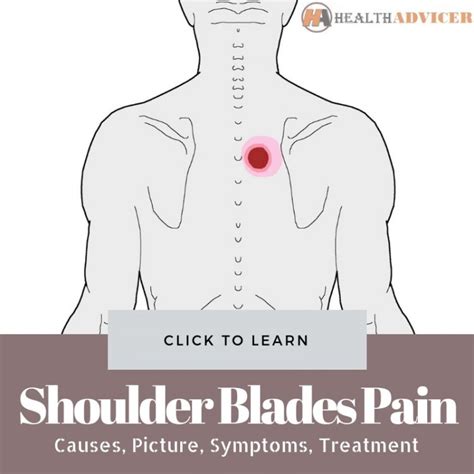 Pain In Between Shoulder Blades