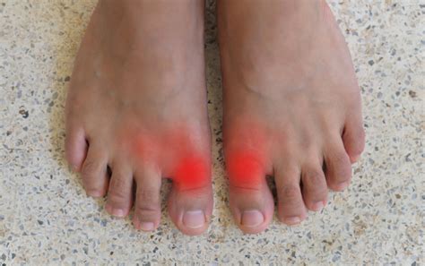 Pain In Big Toe Joint