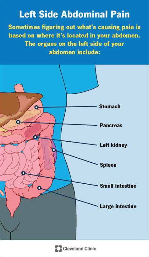 Pain In Bottom Left Abdomen