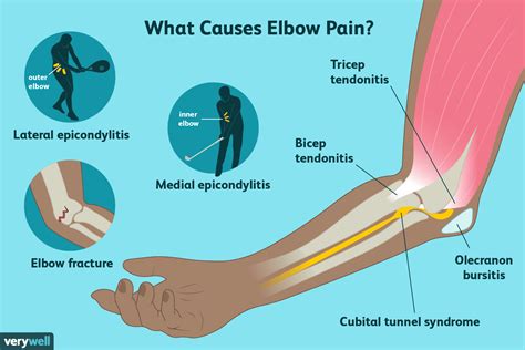 Pain In Elbow Joint