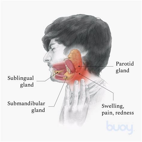 Pain In Neck Under Jaw