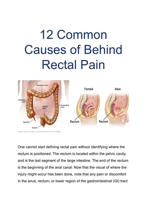 Pain In Rectum