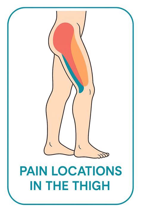 Pain In Upper Thigh