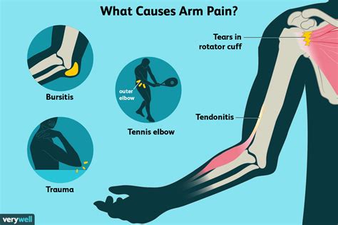 Pain Inside The Arm