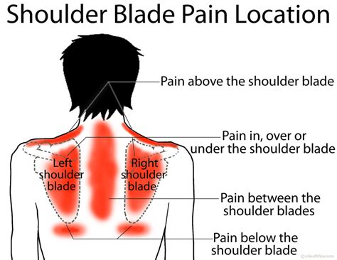 Pain Underneath Shoulder Blade Left