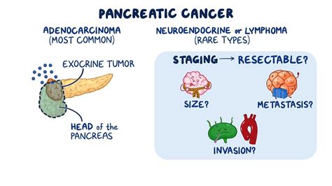 Pancreatic Tumor Metastasis