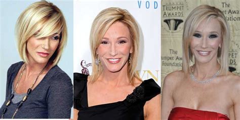 Paula White Face Surgery