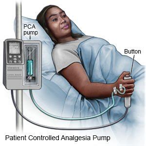 Pca Medical Abbreviation
