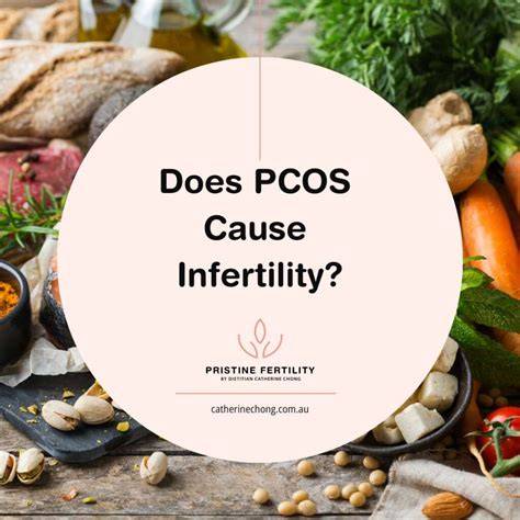 Pcos Does It Cause Infertility