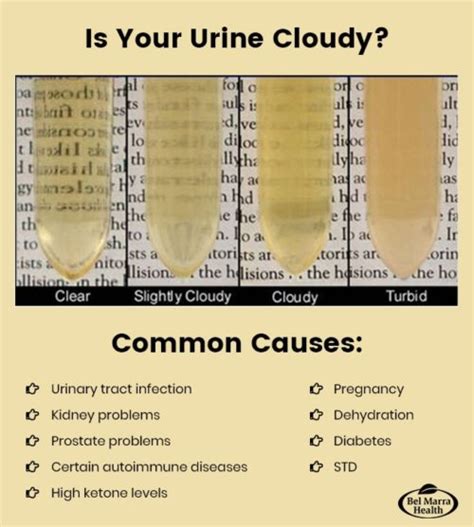 Pee Is Cloudy