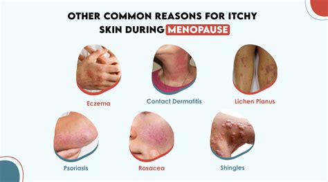 Perimenopause Itchy Skin