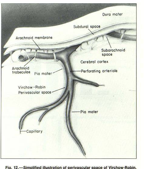 Perivascular Space Of Virchow Robin