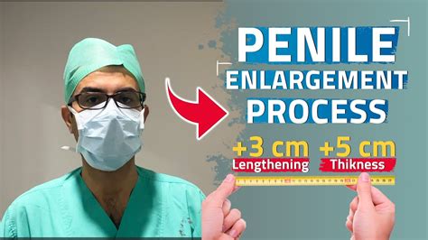 Permanent Male Enlargement Surgery Cost
