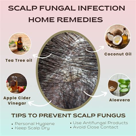 Pics Of Scalp Fungus