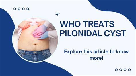 Pilonidal Cyst Treatment
