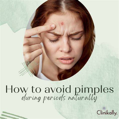 Pimples And Periods