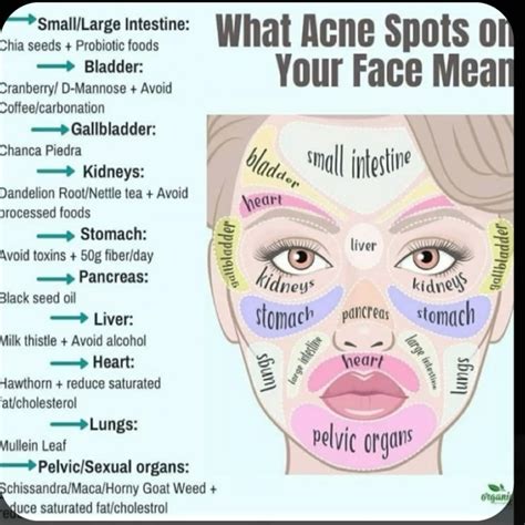 Pimples On Cheeks Meaning