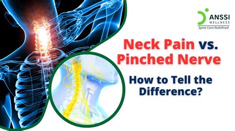 Pinched Nerve In Neck Symptoms