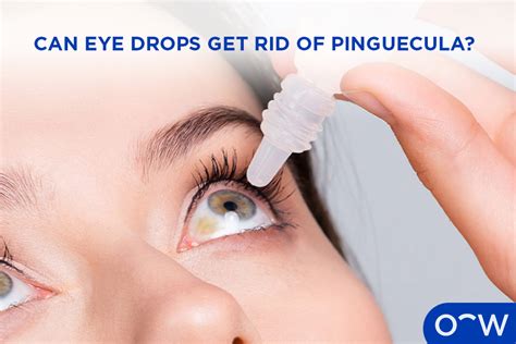 Pinguecula Eye Drops