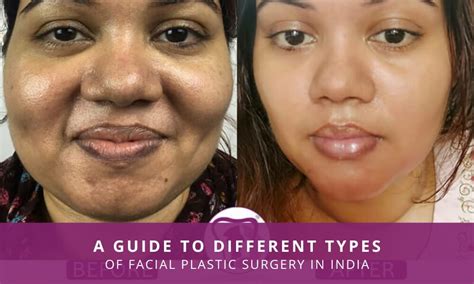 Plastic Surgery Face Price