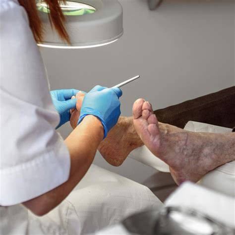 Podiatrist Remove Corns