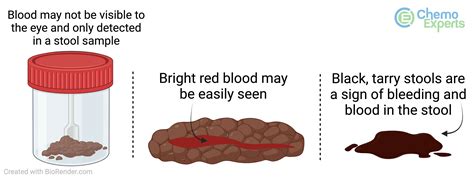 Poop With Blood Pictures
