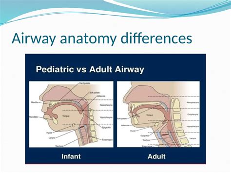 Poor Airway Progression
