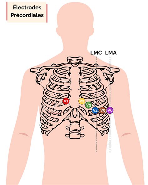 Position Of Ecg Electrodes
