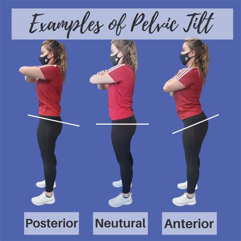 Posterior Pelvic Tilt