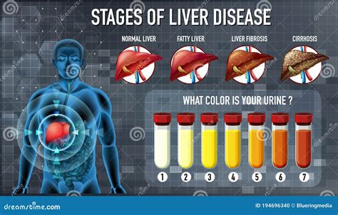 Problems With Liver