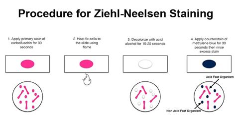 Process Of Zn Staining