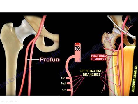 Profunda Femoris Artery